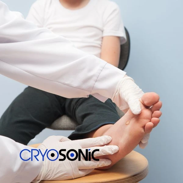 Are you looking for fast effective wart removal Contact us today Waterlooville